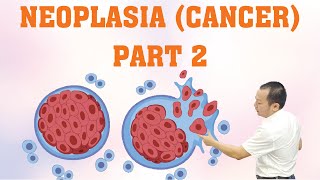 Neoplasia Cancer  Part 2 cancerbiology [upl. by Iel272]