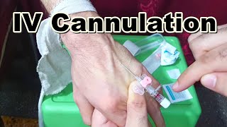 How to Insert IV Cannula  IV Cannulation Technique  Branula  Intravenous Catheter [upl. by Eisyak]