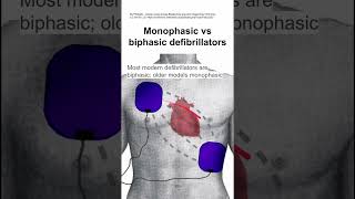 Monophasic vs biphasic defibrillators [upl. by Merrili]