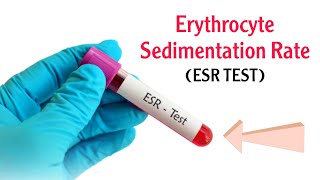 Erythrocyte Sedimentation Rate  ESR  What does ESR test show What does high ESR means [upl. by Renelle]