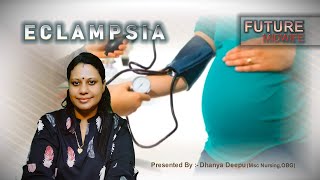 ECLAMPSIA ampITS MANAGEMENTDHANYA DEEPUHIGH RISK PREGNANCYOBG [upl. by Sunshine]