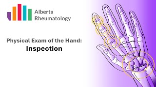 Rheumatology HAND exam Part 2 Inspection [upl. by Macintyre]