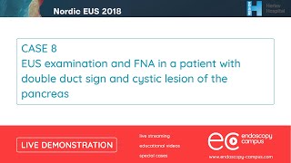 Livedemo  Nordic EUS 2018  EUS examination and FNA n a patient with double duct sign [upl. by Reahard]