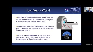 Focused Ultrasound for Essential Tremor and TremorDominant Parkinsons Disease [upl. by Lori]