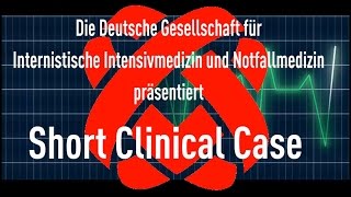 Beidseitige Trommelfellperforation nach Knalltrauma [upl. by Alegnatal596]