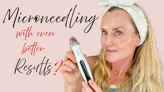 Better Results from Microneedling  New Bio Pen Q2 first impression amp full demo [upl. by Kinzer]