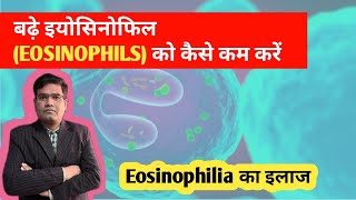 Eosinophilia का इलाज  Treatment of High Eosinophil in Blood [upl. by Rebah711]