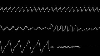 Kirbys Dreamland 3  Ripple Field 2 Virtualboy Cover [upl. by Kerwinn]