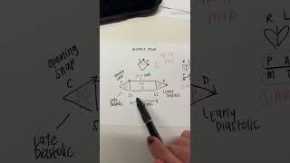 MURMUR MAN FOR CARDIAC MURMURS MNEMONIC [upl. by Tonye778]