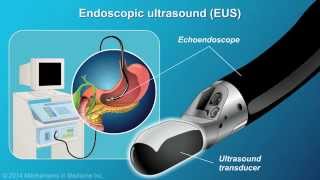 Understanding EUSFNA [upl. by Rachaba]