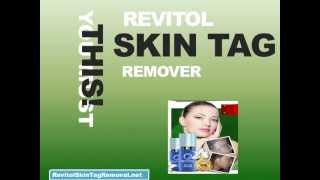 Revitol Skin Tag Removal  Remove Skin Tags Naturally [upl. by Ellennahs]