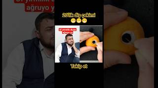 Diş çekimi 😄😃😁 comedy keşfet [upl. by Abramo]