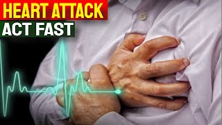 Early Heart Attack Warnings You are Ignoring [upl. by Tessy]