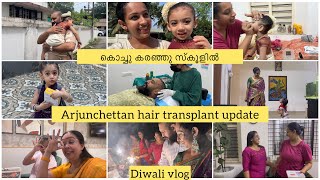 Weekly Vlog  Diwali 2024  hair transplant update  Sowbhagya Venkitesh [upl. by Yhtak]