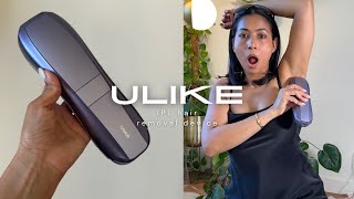 IPL Hair Removal Device on BrownDarker skin  ULIKE Air 10 [upl. by Yracaz]