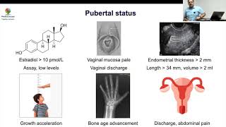 MedEClasses Approach to Precocious Puberty in Girls [upl. by Hedelman]