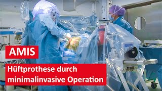 Hüftprothese durch minimalinvasive AMIS Methode  Live Operation [upl. by Iva]