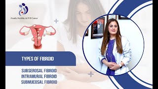 Fibroid Series Part 1  A Comprehensive Overview of Uterine Fibroid Types [upl. by Nomahs]