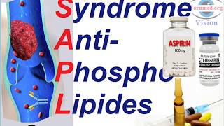 Traitements de du Syndrome des Antiphospholipides SAPL [upl. by Awad712]