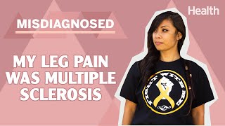 My Leg Pain Was Actually MS  Multiple Sclerosis Misdiagnosed  Health [upl. by Oakes]