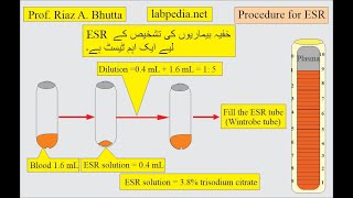 ESR VS CRP by Prof Riaz A Bhutta labpedianet Urdu Hindi [upl. by Ahseram]