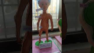 Kwashiorkor and marasmus model project [upl. by Aicileb752]