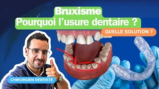 Bruxisme dentaire  comment identifier et traiter efficacement [upl. by Ninnahc394]