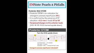 Posterior Wall STEMI doctor medical nursing [upl. by Cleave]