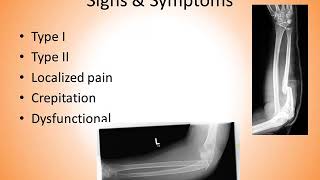 Monteggia Fracture [upl. by Winchester]