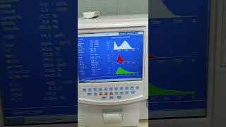 Mindray 3000 plus temperature error [upl. by Finbur]