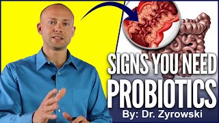 Probiotic Benefits  Top Signs You Should Be Taking A Probiotics [upl. by Burman]