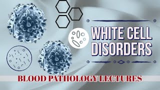 WHITE CELLS DISORDERS lecture 5 LYMPHOID NEOPLASMS some basic rules to follow [upl. by Anelyak635]