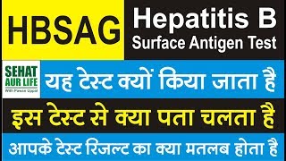 HBSAG Test Hepatitis B surface antigen test यह टेस्ट क्यों किया जाता है इस टेस्ट से क्या पता चलता है [upl. by Ninetta]