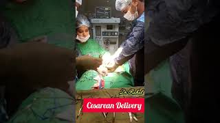 Cesarean Dr Rahul Gynecologist birthvlogs deliveryvlogs [upl. by Eiffub391]