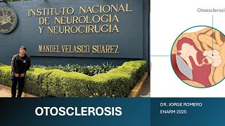 OTOSCLEROSIS  ENARM 2025  GPC [upl. by Lari]