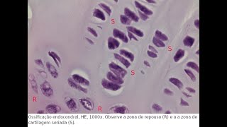 925  ATTO  Ossificação endocondral [upl. by Katrine]