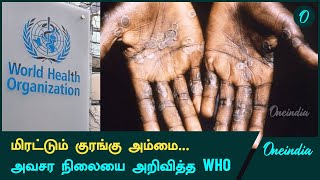 Mpox நோயால் உலக நாடுகளுக்கு ஆபத்து  Oneindia Tamil [upl. by Airb390]