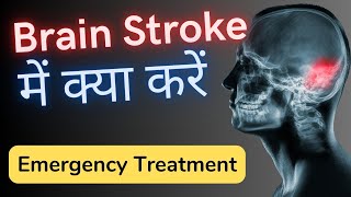 ब्रेन स्ट्रोक  brain stroke treatment in hindi [upl. by Jeni]