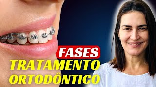 QUAIS SÃO AS FASES DO TRATAMENTO ORTODÔNTICO Dentista Responde [upl. by Areip]