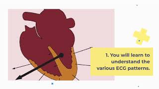 Introduction to Course  ECG interpretation like a Pro [upl. by Waxler]