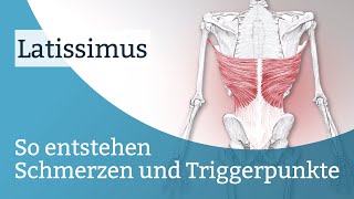 Latissimus Schmerzen Triggerpunkte und deren Aktivierung [upl. by Dinse]