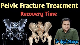 Pelvic Fracture Recovery Time  pelvic Fracture Treatment  pelvic Fracture Exercises  in Hindi [upl. by Epolenep522]