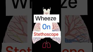 Wheeze on Stethoscope 🩺 Lung sound neetpg fmge medicalstudent [upl. by Ennovihc439]