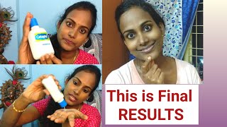 Cetaphil Gentle Skin Cleanser Review amp Demo in Telugu  Best Face wash for Dry amp Sensitive skin [upl. by Carlen]