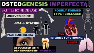 OSTEOGENESIS IMPERFECTA [upl. by Nomahs430]