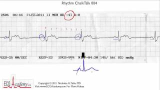 ECG Interpretation Tutorial  ChalkTalk 04  Intermediate Level [upl. by Larisa888]