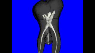 MicroCT of tooth [upl. by Kermie]