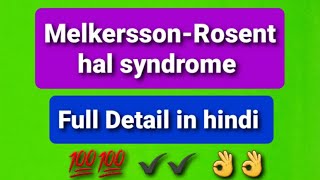 MelkerssonRosenthal Syndrome ent lecture with face vedio [upl. by Starobin]