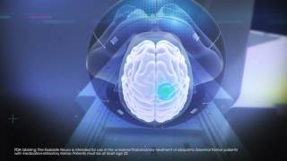 The Future of Medicine starts here INSIGHTECs Exablate Neuro Platform [upl. by Ennairb729]