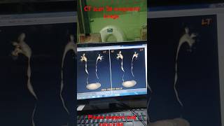 CT scan 3d urography final image reportshortvideo anatomy [upl. by Sholeen]